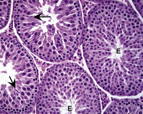 4 Testis From A 35 Day Old Rat Tubules Contain Spermatogonia