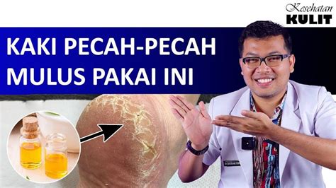 5 Cara Mudah Dan Ampuh Mengatasi Kulit Kaki Dan Tangan Yang Pecah Pecah Secara Alami