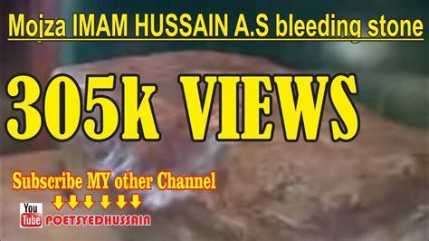 Miracle Miracle Of Imam Hussain A S Mojza Imam Hussain Bleeding