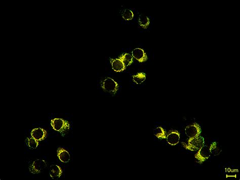 Lipid raft localization of TLR2 and its co-receptors is independent of ...