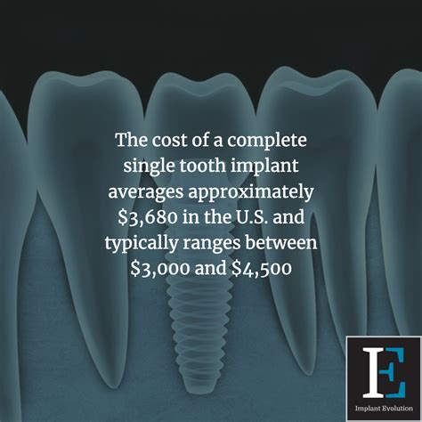 Are There Cheap Dental Implants Implant Evolution