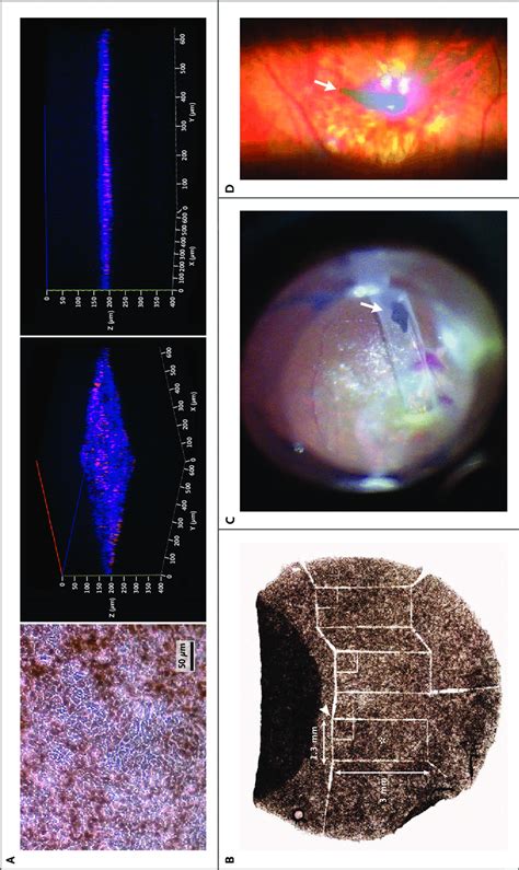 Generation And Transplantation Of The Ipsc Rpe Sheet Panel A The