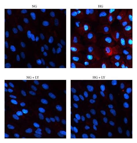 Immunofluorescence Staining Of Fibronectin Collagen Iv And Laminin In