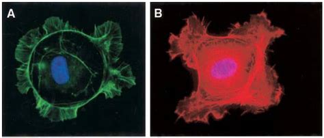 Lamellipodia and filopodia assay - 4Dcell