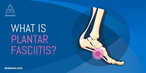 What Is Plantar Fasciitis