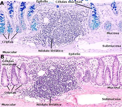 Órganos Animales Sistema Digestivo Intestino Grueso Atlas De