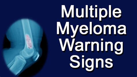 Multiple Myeloma Warning Signs Youtube