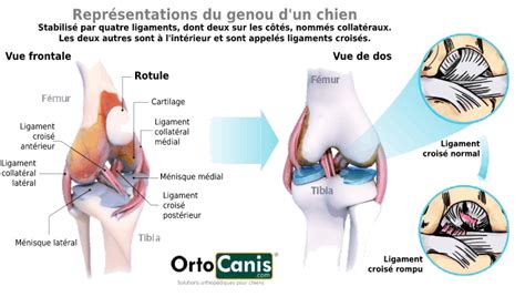 La Rupture Du Ligament Crois Ant Rieur Kin Sith Rapie Et Conseils