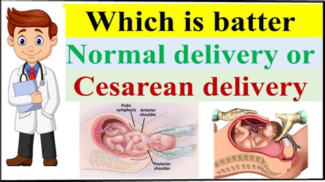 Normal Vs Cesarean Delivery Which Is Better Normal Or Cesarean