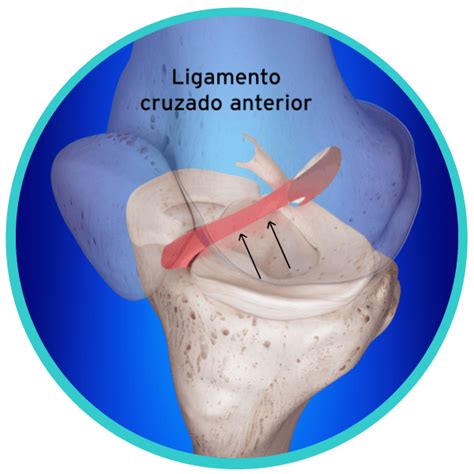 Ligamentos Y Tendones Dra Cristina Ramos