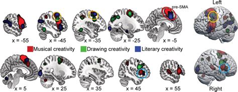 Brain Regions Showing Significant Common Activation Across Musical