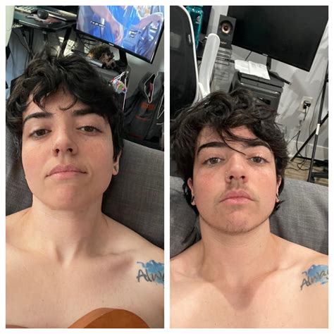 Pre T Vs 2 5 Months On T Holy Facial Hair This Is After Trimming R Ftm Selfies