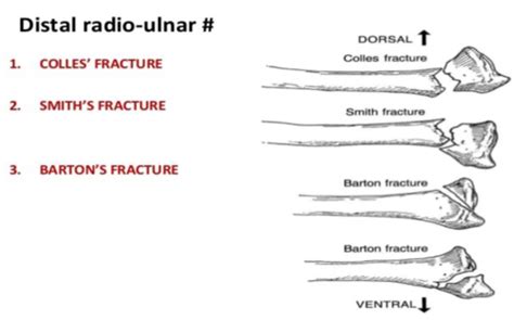 Wrist Area Of Symptoms And Pathologies Flashcards Quizlet