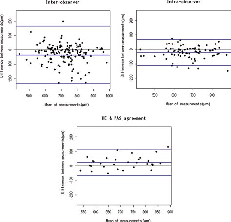 Bland Altman Plots Of The Trabecular Meshwork Length Measurements For