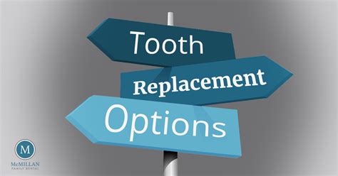 Tooth Replacement Options - McMillan Family Dental