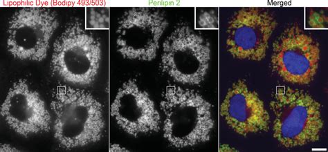 312 Simultaneous Imaging Of Lipid Droplet Cores And Perilipin 2 Huh7