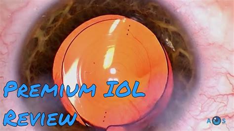 Review Of The Best Premium Intraocular Lenses For Cataract Surgery And