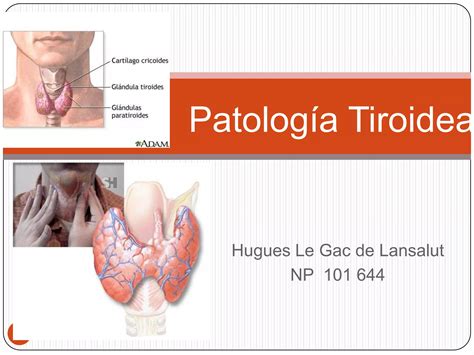 Patologia Tiroidea Ppt