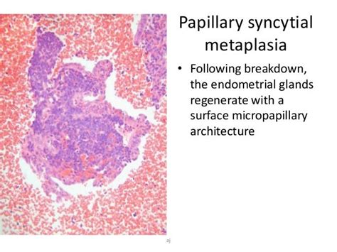 Endometrial Histopathology Basics