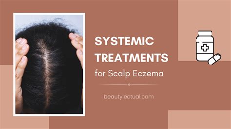 Scalp Eczema Treatment Systemic Treatments Discover Effective Systemic