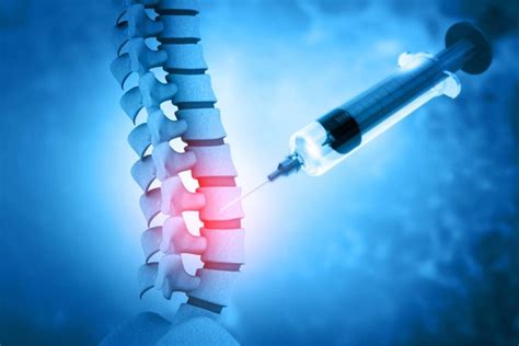 Spinal vs. Epidural Anesthesia - North Dakota Anesthesia Services