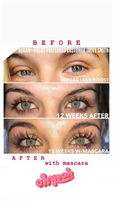 Grow Your Eyelashes In Just Days Artofit