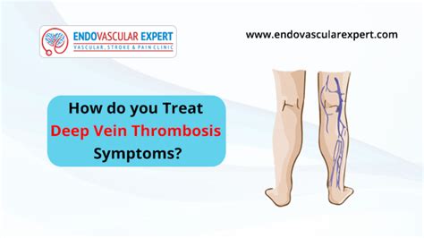 Venous Thrombosis Symptoms