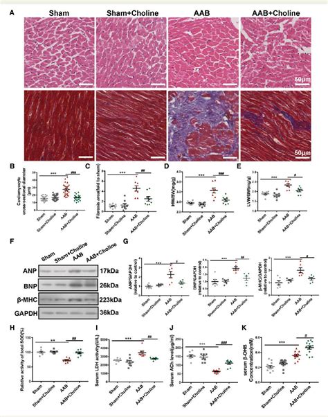 Figure From Choline Ameliorates Cardiac Hypertrophy By Regulating