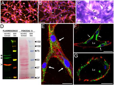 Figure From Autocrine Hyaluronan Influences Sprouting And Lumen