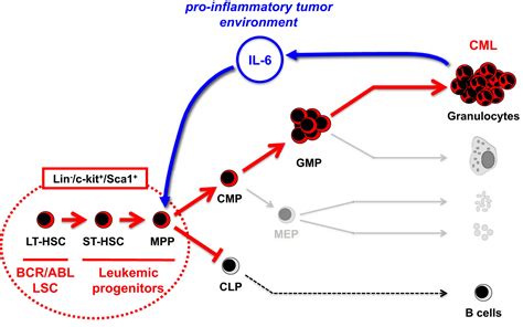 IL 6 Controls Leukemic Multipotent Progenitor Cell Fate And Contributes