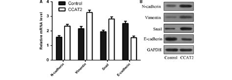 Colon Cancer Associated Transcript Ccat Overexpression Increased