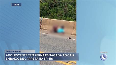 Por Um Triz Adolescente Tem Perna Esmagada Ao Cair Embaixo De Carreta