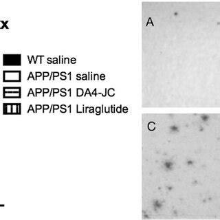 Quantification Of Beta Amyloid Plaque Loads In The Neocortex A Way