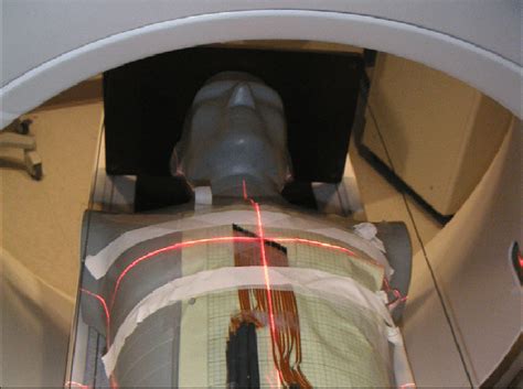 Illustration Of Mosfet Layout On The Central Anterior Chest Surface Of Download Scientific