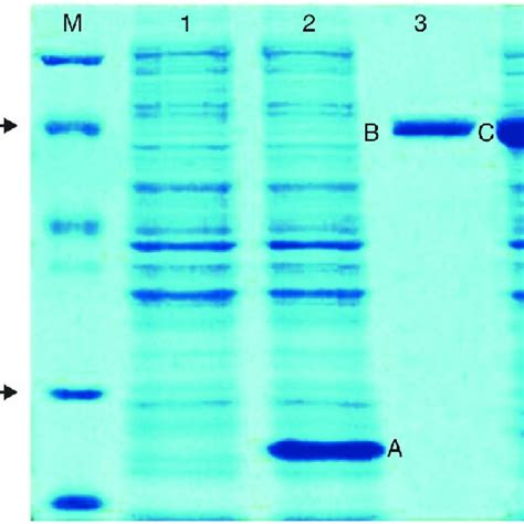 Coomassie Brilliant Blue Stained Sds Polyacrylamide Gel Electophoresis