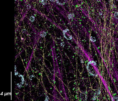 3D Multiplexed Super Resolution Imaging With DNA PAINT And The Vutara