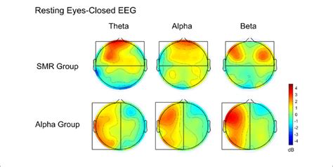 The Difference Of Eeg Power Between Pre Test And Post Test Of The Download Scientific Diagram