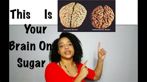 What Is Sugar Doing To Your Brain Youtube