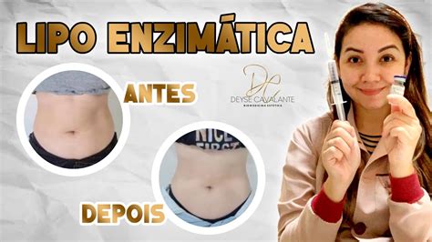 APLICAÇÃO DE ENZIMAS Lipo enzimática funciona Como é o processo Dói