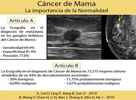 Cáncer De Mama La Importancia De La Normalidad Tempo Formación