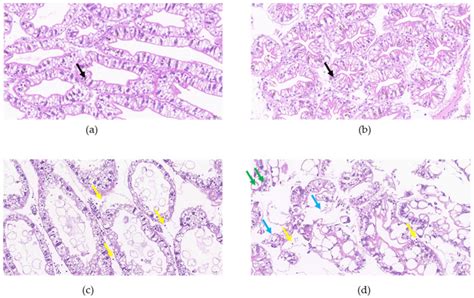 Histological Sections Of Hepatopancreas After Drought A Control And Download Scientific