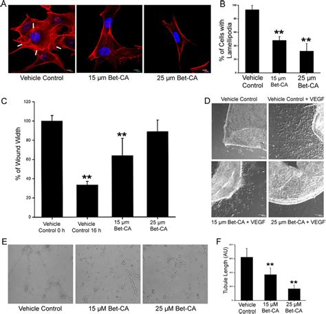 Bet Ca Inhibits Endothelial Cell Migration And Associated Angiogenic