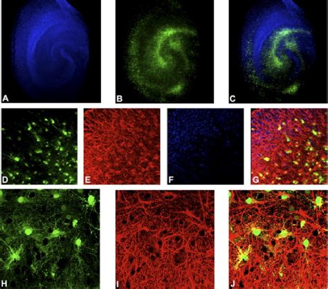 Selective Overexpression Of Excitatory Amino Acid Transporter 2 EAAT2