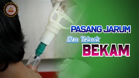 Pasang Jarum Dan Teknik Bekam YouTube