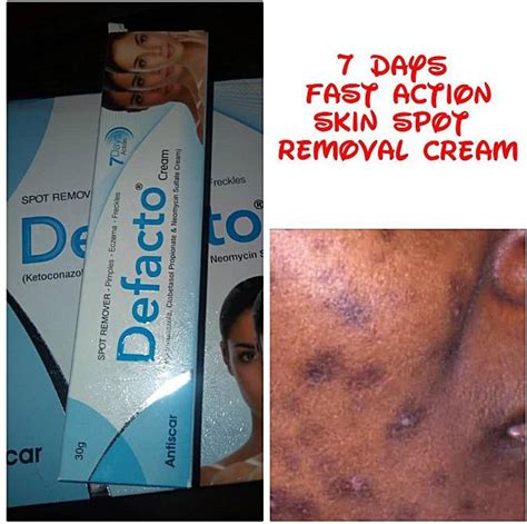 Defacto Fast Action Skin Spot Removal Cream price from jumia in Nigeria ...