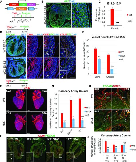 Coronary Artery Development Is Impaired In Rspo3 Deficient Hearts A