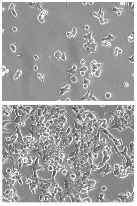 Hct Hnis Neo Reporter Gene Cell Line Imanis Life Sciences