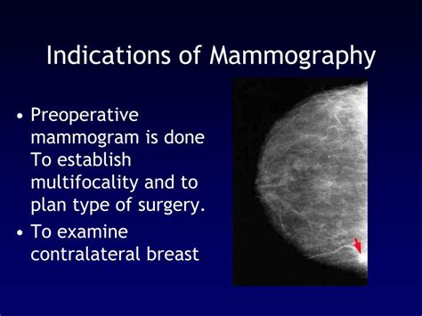 Ppt Early Detection Of Breast Cancer Powerpoint Presentation Free