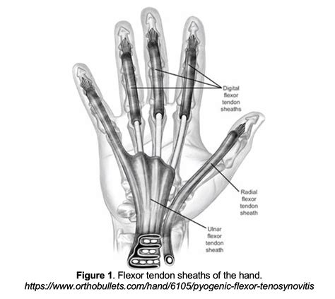 Emergency Medicine Educationem 3am Pyogenic Flexor Tenosynovitis