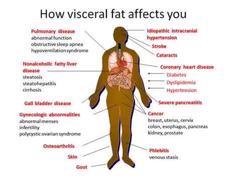 8 Strategies To Reduce Visceral Fat Marsha Fenwick Nutrition